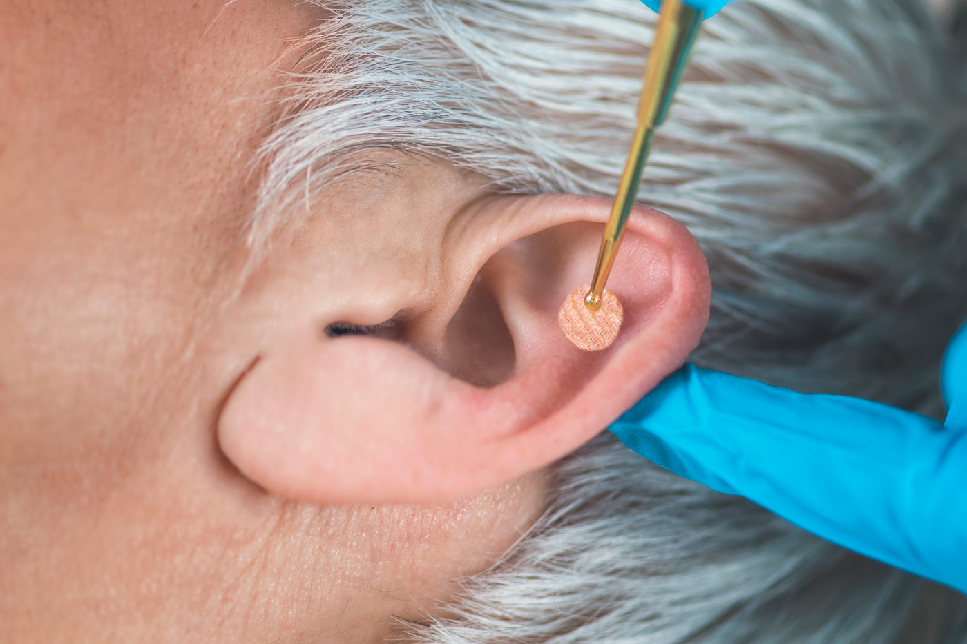 corso Auricoloterapia